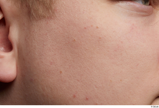 HD Face skin references Tom Jenkins cheek skin pores skin…